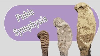 Pubic symphysis aging  Osteology tutorial [upl. by Sivartal]