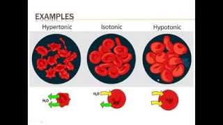 ACHSedu HypertonicHypotonic by Dr Jerry Cronin [upl. by Ynabe]