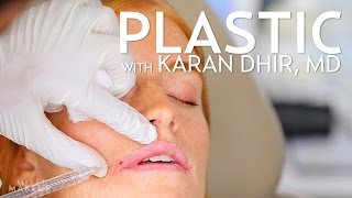 Lip Injections with Filler Bow and Arrow Technique  PLASTIC with Dr Dhir [upl. by Hiasi439]