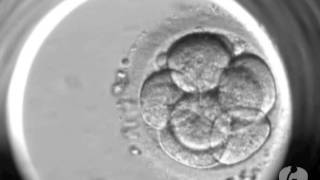 Evolução dos embriões no Laboratório de Reprodução Humanawmv [upl. by Haze]