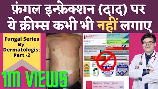 Ringworm Fungal Infection Treatment In Hindi  Fungal Infection Cream Without Steroids  Dr Sunil [upl. by Alilad612]