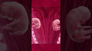 Twin wonders in mothers womb  Types of Twins  Twin baby pregnancy twins twinsbaby [upl. by Atterys]