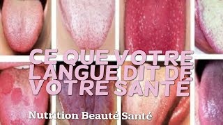 Ce que votre langue dit de votre santé [upl. by Tia]