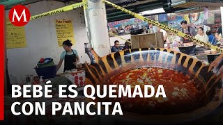 Bebé de 4 meses sufre quemaduras tras caerle una cazuela hirviendo en Amecameca [upl. by Idnak843]