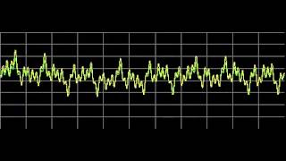 Lung Diseases  Rife Frequencies [upl. by Tabb373]