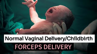 Normal vaginal DeliveryChildbirth deliveryLabor pain stagesCervix Dilation during pregnancy🧘 [upl. by Eeliram]