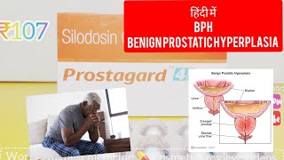 Prostagard silodosin tablet uses in Hindi BPH का ट्रीटमेंट [upl. by Dhruv274]