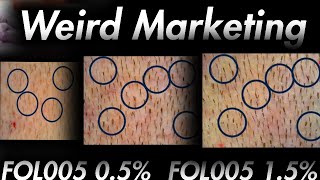 Is FOL005 Better Than FinasterideMinoxidil Nope  Scamish [upl. by Atik]