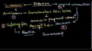 Listeria monocytogenes infection [upl. by Uile]