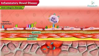 Inflammatory Bowel Disease Pharmacology Lectures [upl. by Kaela]