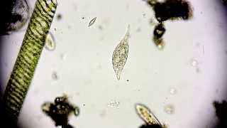 Amphileptus meleagris  Ciliate  Wimpertierchen  Hemiophrys meleagris  microorganisms microscope [upl. by Kutchins614]