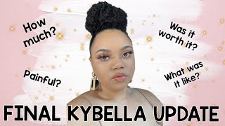 Final Kybella Update  Everything you need to know before you go [upl. by Riana599]