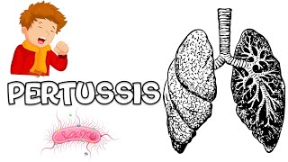 Pertussis Whooping Cough  Causes Signs amp Symptoms Complications Diagnosis And Treatment [upl. by Ahrens342]