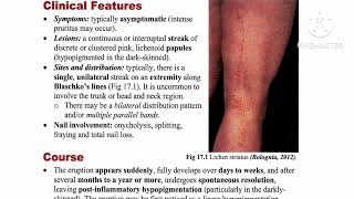 2 Lichenoid Review ✅ Lichen nitidus 🔸 Lichen striatus 🔸 Graft versus host disease by Dr Ahmed Kamel [upl. by Dodi]