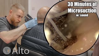 30 Minutes of MICROSUCTION Ear Wax Removal [upl. by Dibb]