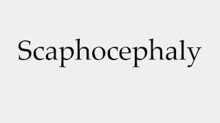 How to Pronounce Scaphocephaly [upl. by Turro]