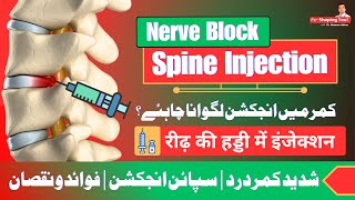 Nerve Block Injection  Good or Bad  UrduHindi [upl. by Wendelina893]