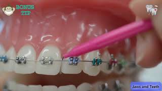 InterDental Brushing Jaws and Teeth Dental Clinic [upl. by Eednas457]