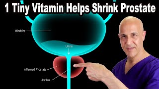 1 Tiny Vitamin Helps Shrink Your Enlarged Prostate  Dr Mandell [upl. by Etnaled318]