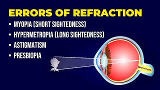 Errors of Refraction  Myopia  Hypermetropia  Astigmatism  Presbiopia  Short amp Long Sightedness [upl. by Oshinski]