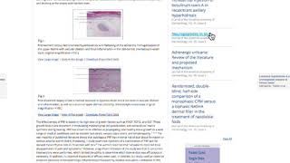 BXO lichen sclerosus in men treatment [upl. by Hourigan]