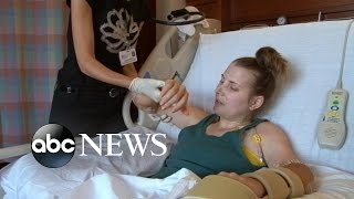 Lindsay Ess Story Part 1 Quadruple Amputee Undergoes Double Hand Transplant Surgery [upl. by Lozano157]