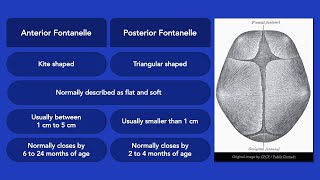 Fontanelles [upl. by Auohc890]