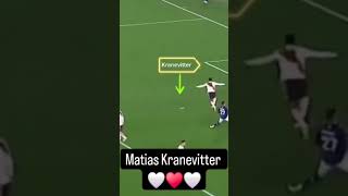 Matias Kranevitter Lo mejor que verás hoy [upl. by Lydnek]