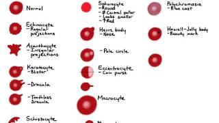 RBC Morphology [upl. by Richart]