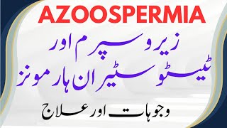 azoospermiatestosteronharmonstestosterone kya hota haiزیرو سپرم [upl. by Avihs]