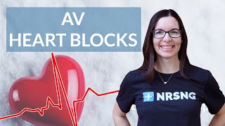 How to interpret AV Heart Blocks on an EKG strip [upl. by Brendon917]