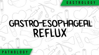 GastroEsophageal Reflux  Physiopathology Symptoms Complications Treatment [upl. by Cassey]