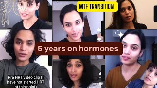 5 years MTF transition clips gendertransition [upl. by Edric]