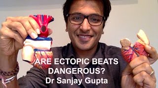 Are ectopic heart beats dangerous [upl. by Airamahs]