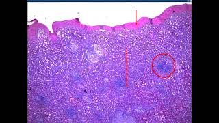 Sarcoidosis Rhino Actinomycosis Leprosy FB 2024  jars and slides [upl. by Atiuqa421]