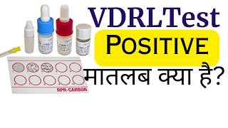 VDRL Test Hindi  VDRL test kya hota hai [upl. by Hospers]