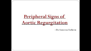 Peripheral signs of Aortic Regurgitation Dr Sameena Farheen [upl. by Geoffrey]