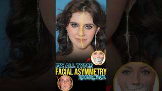 Fix Asymmetrical Face [upl. by Berger]