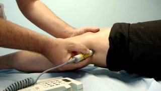 Popliteal pulse assessment with Doppler 8  5mhz probes [upl. by Previdi]