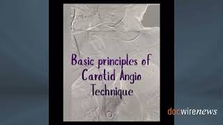 Practice Tips With Dr Lichaa The Basic Principles of Carotid Angiography Technique [upl. by Ahsaele]