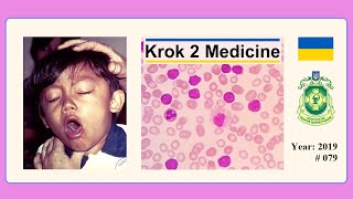 Krok 2 Medicine  Year 2019  079 Ministry of Public Health of Ukraine [upl. by Mauro]