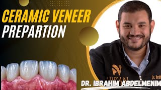 Ceramic veneer preparation  Dr Ibrahim Abdelmunim [upl. by Thorwald887]