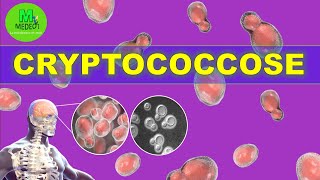 CRYPTOCOCCOSE  cours de mycologie médicale [upl. by Dituri977]