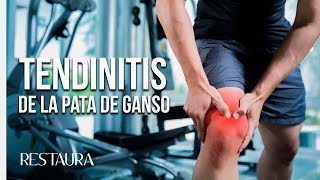 Tendinitis de la pata de ganso [upl. by Doykos]