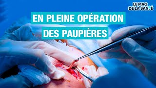 👁️ Une chirurgie pour remonter les PAUPIÈRES  Allo Docteurs [upl. by Assek]