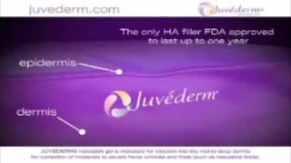 Juvederm  Dermal Filler [upl. by Delamare]