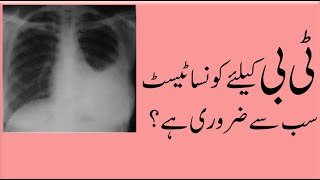 TB Diagnosis explainedٹی بی کیلئے کونسے ٹیسٹ ضروری اور کونسے غیر اہم ہیں؟ [upl. by Mortensen804]