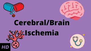 CerebralBrain Ischemia Causes Signs and Symptoms Diagnosis and Treatment [upl. by Felipa]