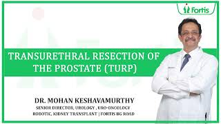 Dr Mohan Keshavamurthy on Laser Transurethral resection of the prostate TURP [upl. by Seldon681]