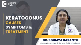 Keratoconus Symptoms amp Treatment Chronic Eye Rubbing vision  Dr Soumya Basanth Doctors Circle [upl. by Heisel]